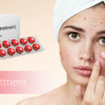 Isotretinoin is Good For Acne