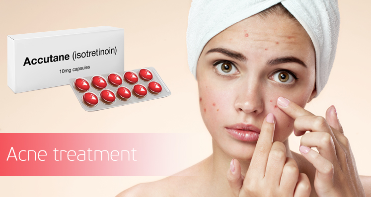 Isotretinoin is Good For Acne