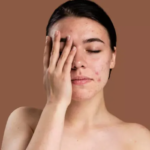bhskin - Publicpill | #1 Trusted, Convenient, and affordable pharmacy, which Isotretinoin Brand is Best accutane 10