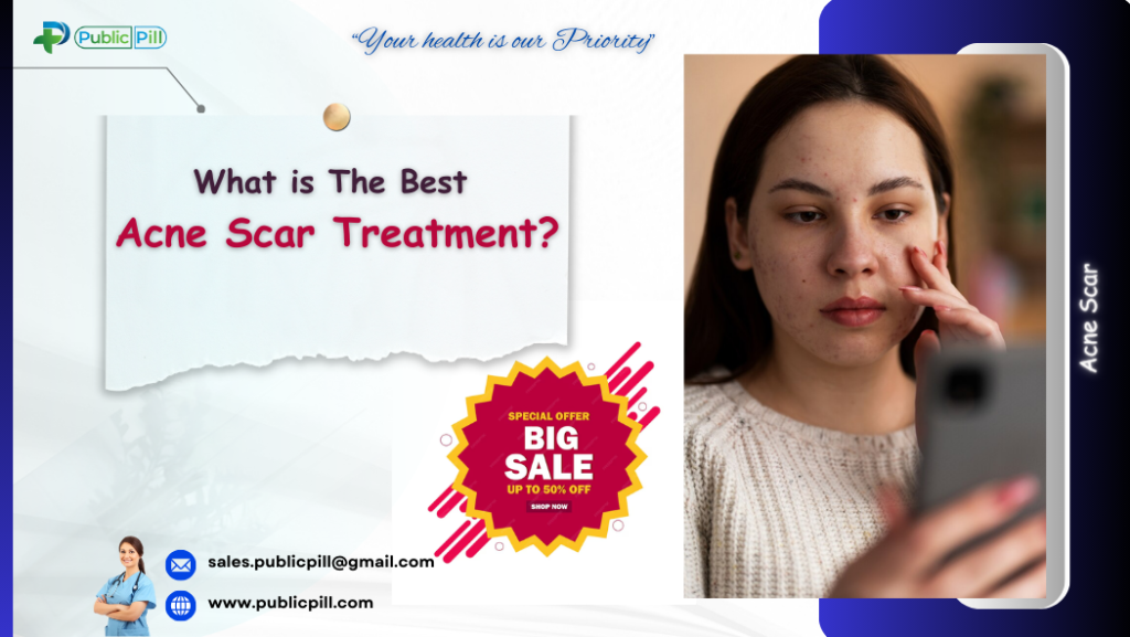 What is The Best acne scar treatment?