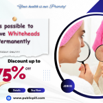 Whiteheads