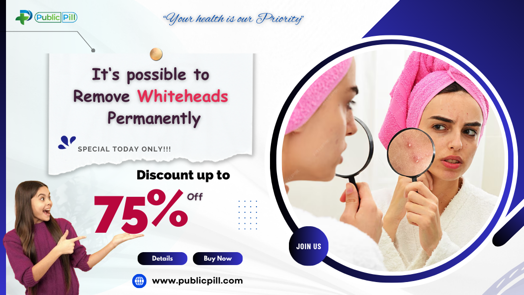 Whiteheads - Publicpill | #1 Trusted, Convenient, and affordable pharmacy, Whiteheads