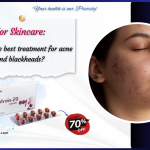 acne and blackheads