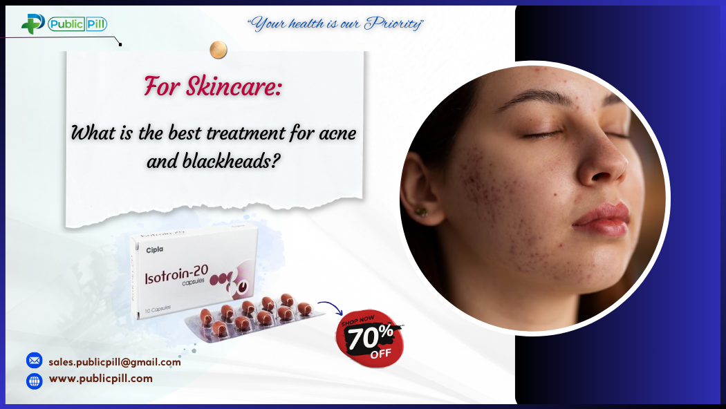 acne and blackheads - Publicpill | #1 Trusted, Convenient, and affordable pharmacy, acne and blackheads