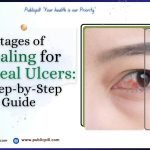 Stages of Healing for Corneal Ulcers: A Step-by-Step Guide