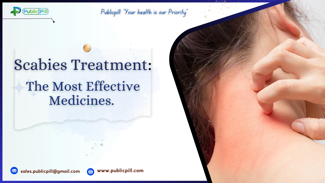 Scabies Treatment: The Most Effective Medicines Explained