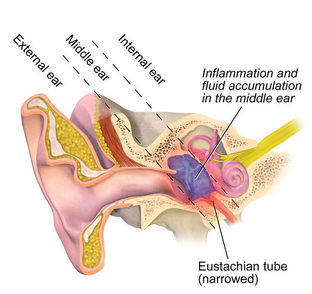 main problem ear Infections Ear Infections