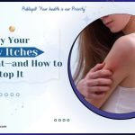 Publicpill online pharmacy 4 - Publicpill | #1 Trusted, Convenient, and affordable pharmacy, Why Your Body Itches in the Heat—and How to Stop It