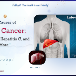 Top Causes of Liver Cancer Hepatitis B Hepatitis C and More - Publicpill | #1 Trusted, Convenient, and affordable pharmacy, Top Causes of Liver Cancer Hepatitis B, Hepatitis C, and More