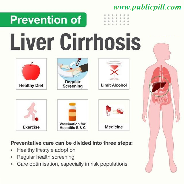 Prevent Liver Cirrhosis