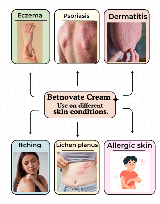 Uses Of Betnovate Creams Uses Of Betnovate Creams