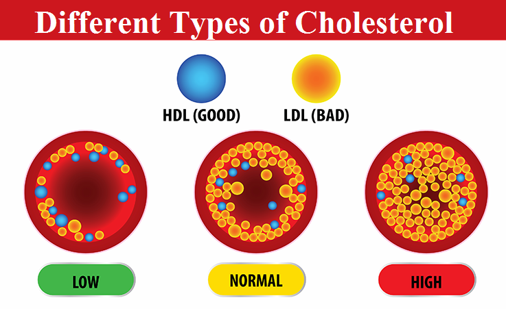 different types of cholesterol different types of cholesterol