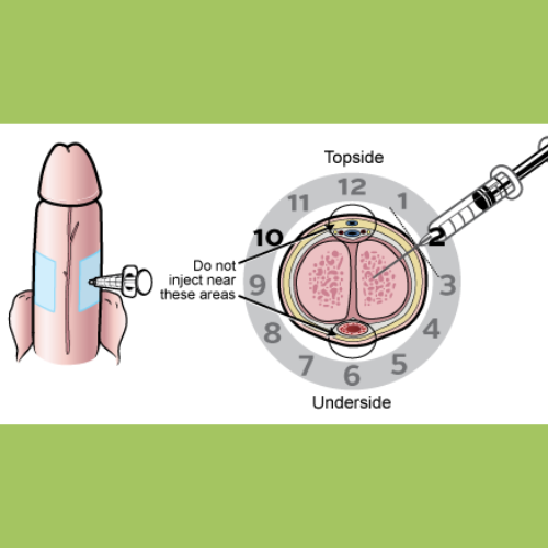 Bimix Injection - papaverine and phentolamine