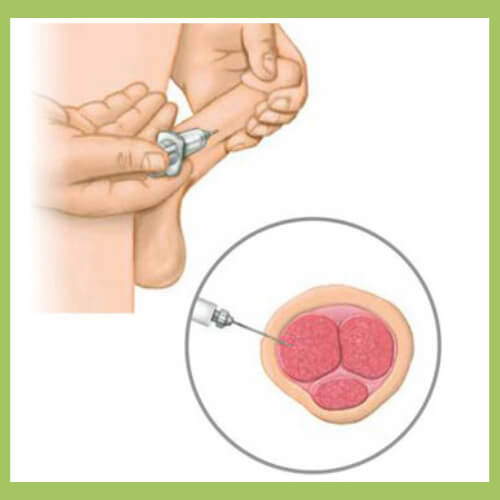 Super Bimix Injection with express USA shipping - Reliable ED treatment by PublicPill.