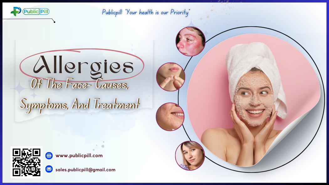 Allergies Of The Face Causes Symptoms And Treatment - Publicpill | #1 Trusted, Convenient, and affordable pharmacy, Allergies Of The Face- Causes, Symptoms, And Treatment