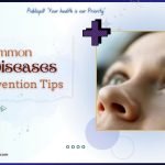 Common Eye Diseases and Prevention Tips - Publicpill | #1 Trusted, Convenient, and affordable pharmacy, Common Eye Diseases and Prevention Tips