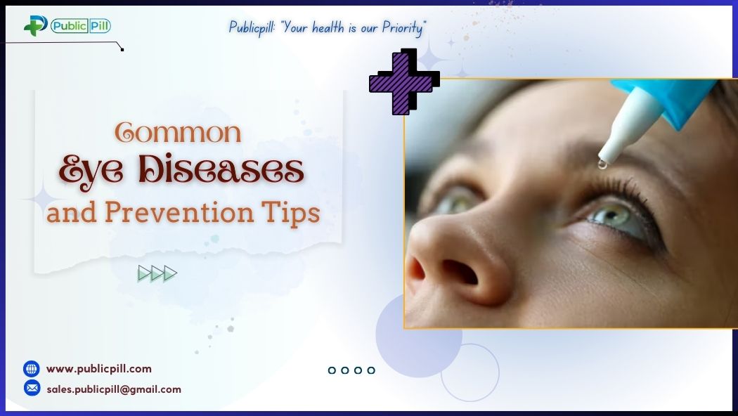 Common Eye Diseases and Prevention Tips