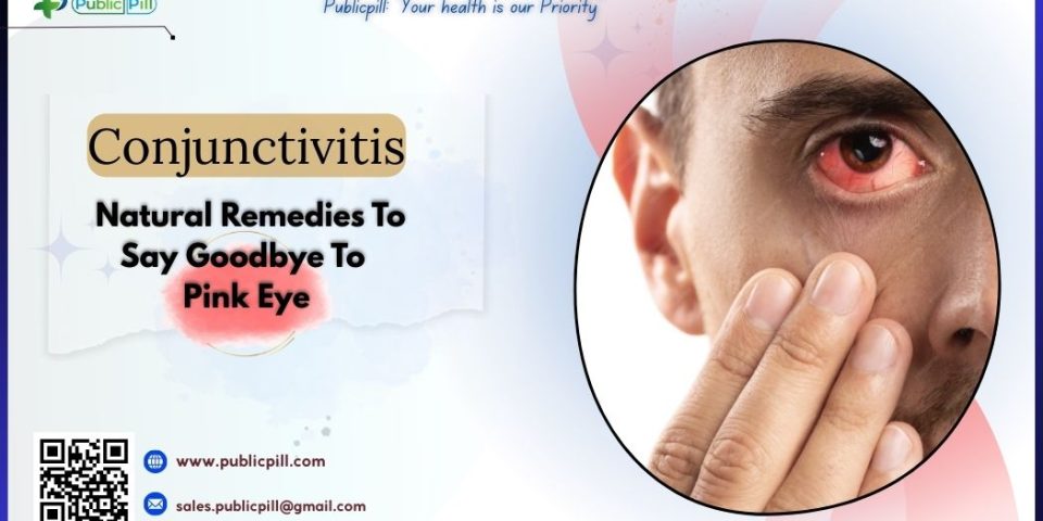 Conjunctivitis- Natural Remedies To Say Goodbye To Pink Eye