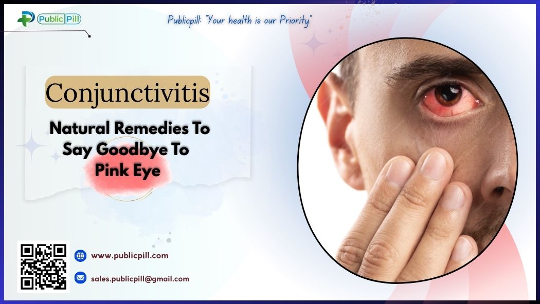 Conjunctivitis- Natural Remedies To Say Goodbye To Pink Eye