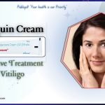Is Benoquin Cream an Effective Treatment for Vitiligo