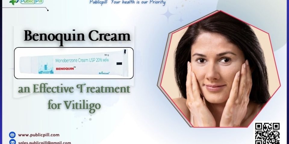 Is Benoquin Cream an Effective Treatment for Vitiligo - Publicpill | #1 Trusted, Convenient, and affordable pharmacy, Is Benoquin Cream an Effective Treatment for Vitiligo