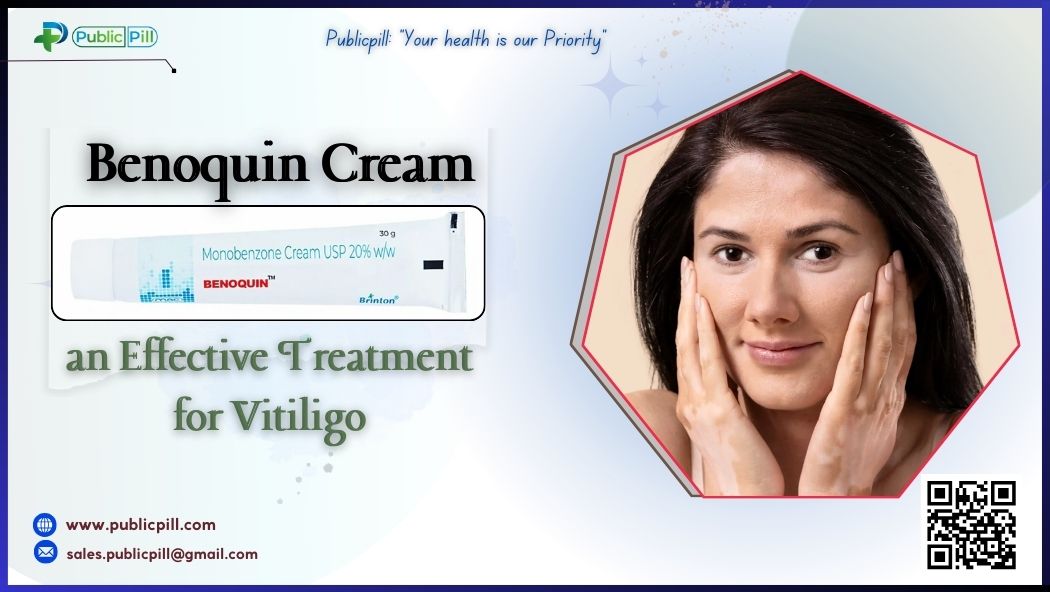 Is Benoquin Cream an Effective Treatment for Vitiligo - Publicpill | #1 Trusted, Convenient, and affordable pharmacy, Is Benoquin Cream an Effective Treatment for Vitiligo