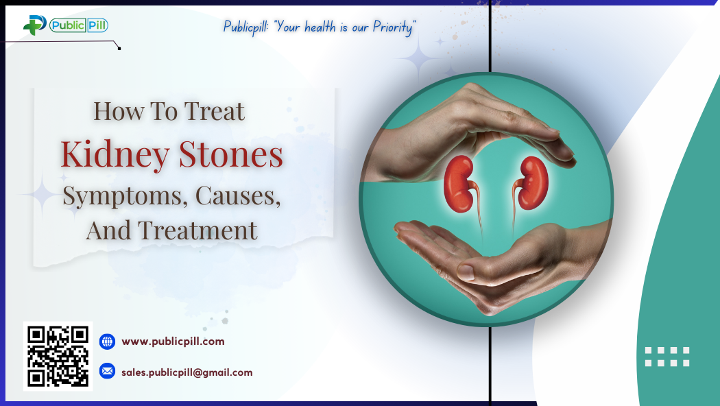 How To Treat Kidney Stones- Symptoms, Causes, And Treatment