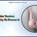 Men's health diagram showing testicular torsion symptoms and spermatic cord twisting.