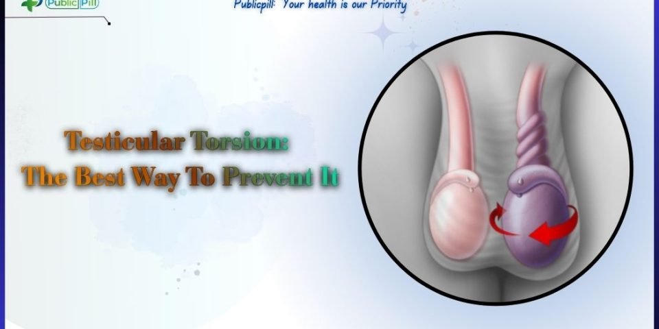 Men's health diagram showing testicular torsion symptoms and spermatic cord twisting.
