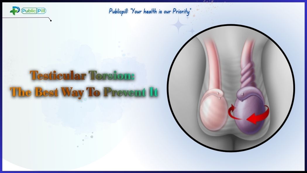 Men's health diagram showing testicular torsion symptoms and spermatic cord twisting.