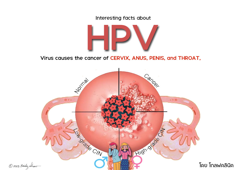 Medical illustration highlighting common penile cancer risk factors, including HPV infection, smoking, poor hygiene, and phimosis.